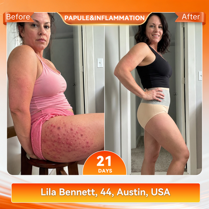 𝐎𝐟𝐟𝐢𝐜𝐢𝐚𝐥 𝐁𝐫𝐚𝐧𝐝 𝐒𝐭𝐨𝐫𝐞 👙 𝐏𝐀𝐔𝐑𝐀𝐉𝐔® 𝟐𝟎𝟐𝟔 𝐌𝐨𝐫𝐢𝐧𝐠𝐚 & 𝐁𝐞𝐫𝐛𝐞𝐫𝐢𝐧𝐞 𝟒-𝐈𝐧-𝟏 𝐌𝐢𝐜𝐫𝐨-𝐏𝐚𝐫𝐭𝐢𝐜𝐥𝐞 𝐒𝐜𝐮𝐥𝐩𝐭𝐢𝐧𝐠 & 𝐅𝐚𝐭-𝐁𝐮𝐫𝐧 𝐒𝐡𝐨𝐫𝐭𝐬