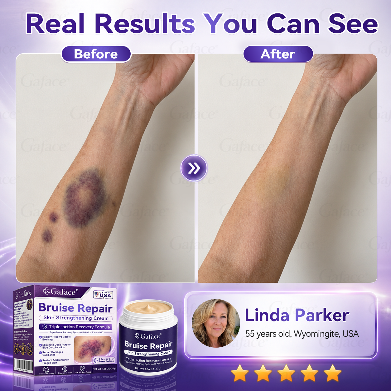 𝑮𝒂𝒇𝒂𝒄𝒆® 𝑩𝒓𝒖𝒊𝒔𝒆 𝑹𝒆𝒑𝒂𝒊𝒓 & 𝑺𝒌𝒊𝒏-𝑺𝒕𝒓𝒆𝒏𝒈𝒕𝒉𝒆𝒏𝒊𝒏𝒈 𝑪𝒓𝒆𝒂𝒎 ⏰Enjoy an exclusive 30% discount⏰