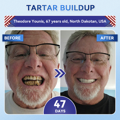 𝑮𝒍𝒊𝒎𝒎𝒆𝒓𝒍𝒚® 🎋 Tideglusib Fast‑Dissolving Tooth & Gum Repair Oral Strips(Supports tooth repair and helps relieve gum discomfort and other common oral concerns)