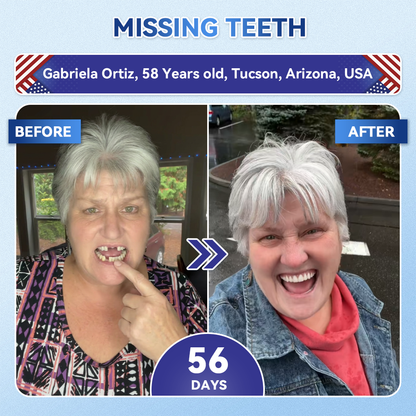 𝑮𝒍𝒊𝒎𝒎𝒆𝒓𝒍𝒚® 🌲 Tideglusib Fast‑Dissolving Tooth & Gum Repair Oral Strips(Supports tooth repair and helps relieve gum discomfort and other common oral concerns)