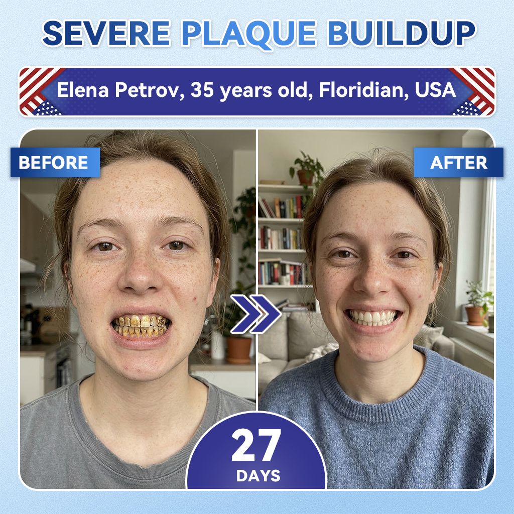 𝑮𝒍𝒊𝒎𝒎𝒆𝒓𝒍𝒚® 🎋 Tideglusib Fast‑Dissolving Tooth & Gum Repair Oral Strips(Supports tooth repair and helps relieve gum discomfort and other common oral concerns)