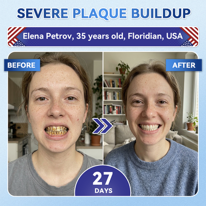 𝑮𝒍𝒊𝒎𝒎𝒆𝒓𝒍𝒚® 🎋 Tideglusib Fast‑Dissolving Tooth & Gum Repair Oral Strips(Supports tooth repair and helps relieve gum discomfort and other common oral concerns)