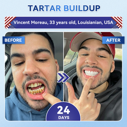 𝑮𝒍𝒊𝒎𝒎𝒆𝒓𝒍𝒚® 🎋 Tideglusib Fast‑Dissolving Tooth & Gum Repair Oral Strips(Supports tooth repair and helps relieve gum discomfort and other common oral concerns)