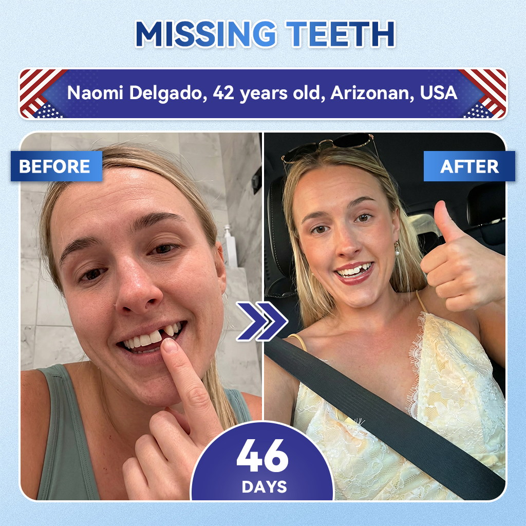 𝑮𝒍𝒊𝒎𝒎𝒆𝒓𝒍𝒚® 🎋 Tideglusib Fast‑Dissolving Tooth & Gum Repair Oral Strips(Supports tooth repair and helps relieve gum discomfort and other common oral concerns)