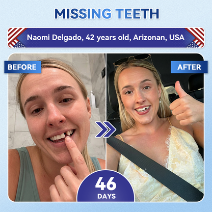 𝑮𝒍𝒊𝒎𝒎𝒆𝒓𝒍𝒚® 🎋 Tideglusib Fast‑Dissolving Tooth & Gum Repair Oral Strips(Supports tooth repair and helps relieve gum discomfort and other common oral concerns)