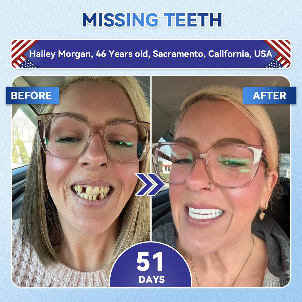 𝑮𝒍𝒊𝒎𝒎𝒆𝒓𝒍𝒚® 🌲 Tideglusib Fast‑Dissolving Tooth & Gum Repair Oral Strips(Supports tooth repair and helps relieve gum discomfort and other common oral concerns)