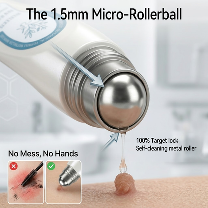 𝐏i𝐜𝐝o® 7-𝐷𝑎𝑦 𝗧𝐚𝐠 & 𝗦𝗽𝐨𝐭 𝐄𝐫𝒂𝒔𝒆𝒓(Zero Pain, Zero 𝐒𝐜𝐚𝒓𝒔 Rollerball)🌲